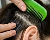 ჭაღარასთან, ბრძოლა, გაჭაღარავების, თავიდან, აცილება, როგორ, ვებრძოლოთ, ჭაღარას