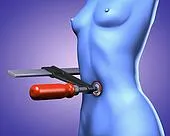 ანორექსია, მოდა, ბულემია