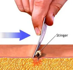 ფუტკრის შხამის ეფექტური მოქმედება ფუტკრის შხამის ეფექტური მოქმედება