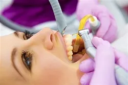 როგორ დავაღწიოთ თავის კბილების მგრძნობელობის მომატებას