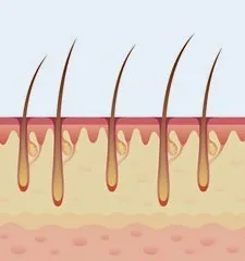 როგორ არის აგებული ადამიანის თმა