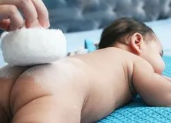 ნასიცხის მკურნალობა