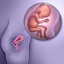 ფეხმძიმობის მე 11 კვირა