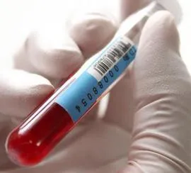 ფეხმძიმობის მე-16 კვირა - ალფაფეტოპროტეინი