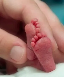 ორსულობის 29-ე კვირა - დღენაკლული ბავშვი