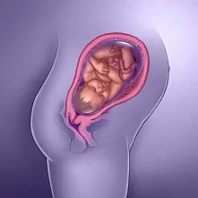 ფეხმძიმობის 38-ე კვირა