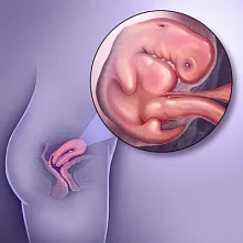 ფეხმძიმობის მე-5 კვირა