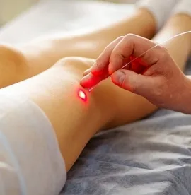 ვარიკოზის ლაზერით მკურნალობა